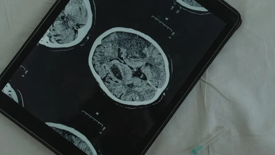 Functional MRI 3D brain render glowing in response to visual branding stimuli